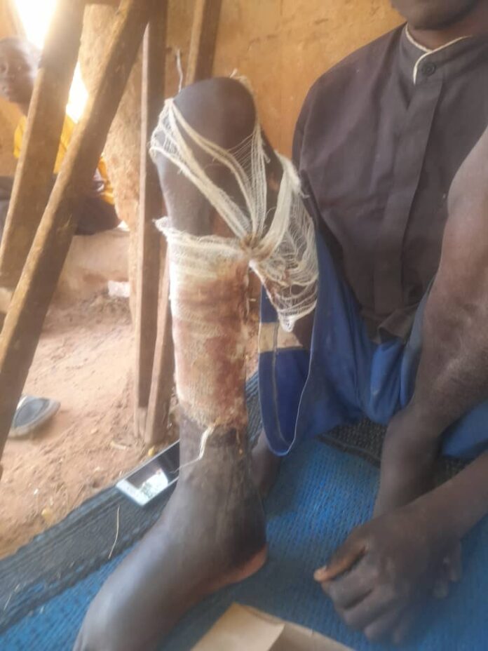 Ƙira Zuwa Ga Taimako: Taimakawa Musa Yakubu don yaƙar cutar daji (Hotuna da Bidiyo)