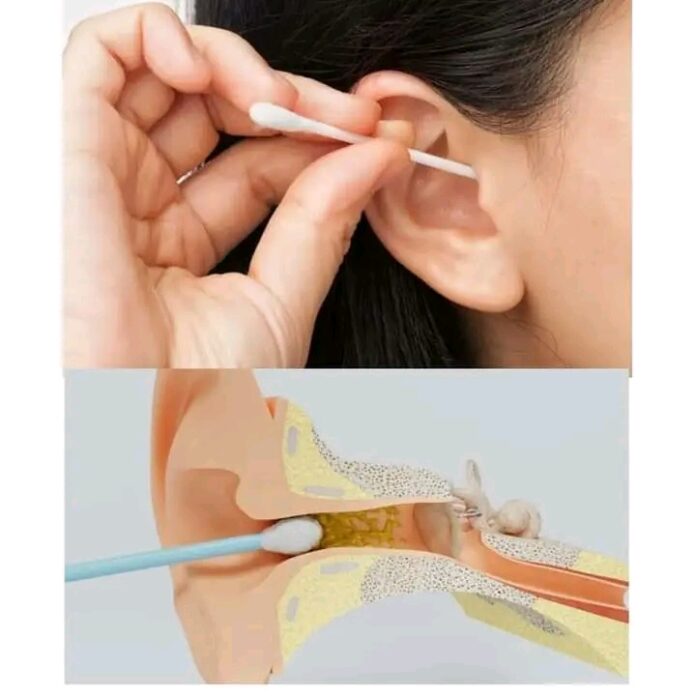 Amfanin 'dauɗar kunne' da illar ƙwaƙwale ta