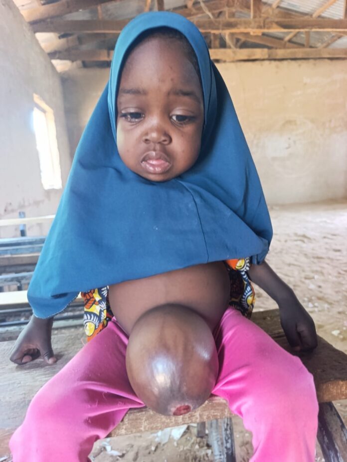 Waye zai ceci rayuwar Hauwa, yarinya 'yar shekara 3